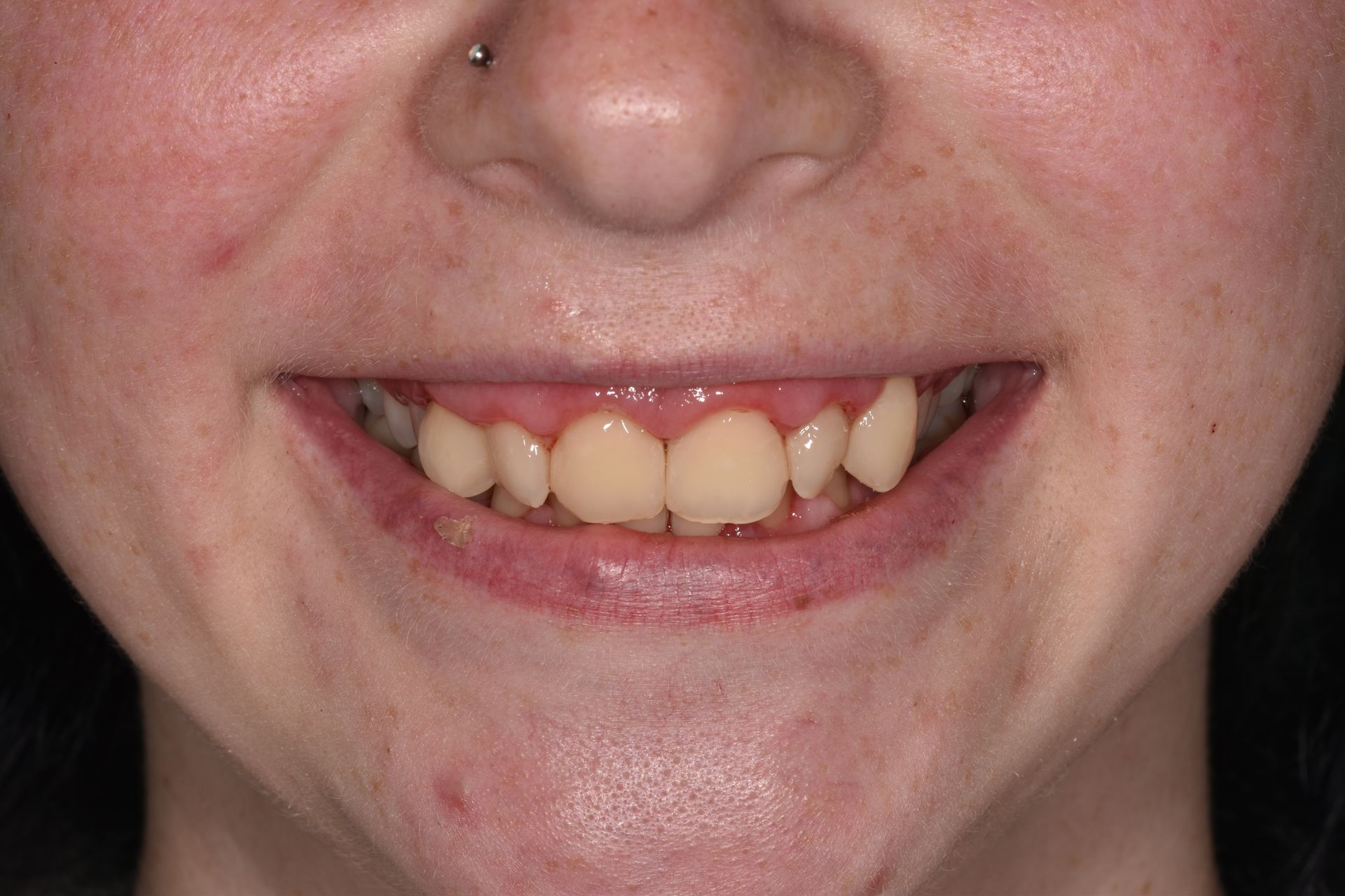 A close up of a woman 's mouth with a nose ring.