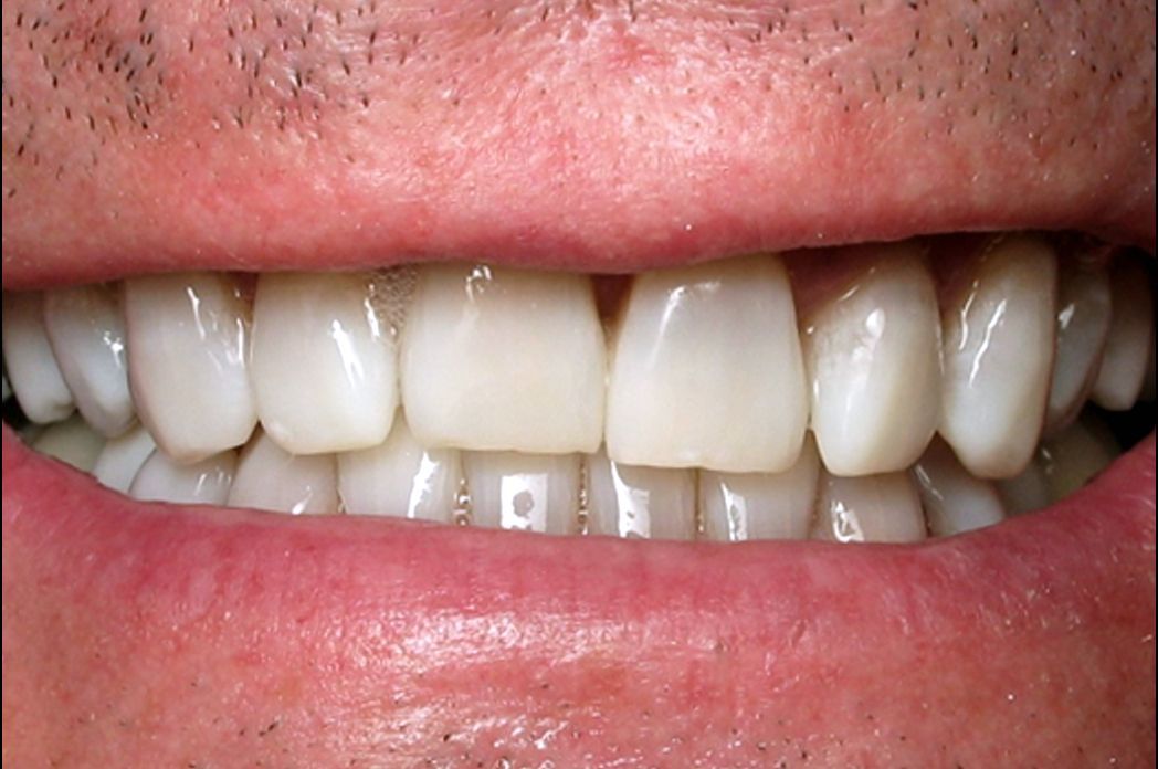 A close up of a man 's face with a smile on his face.