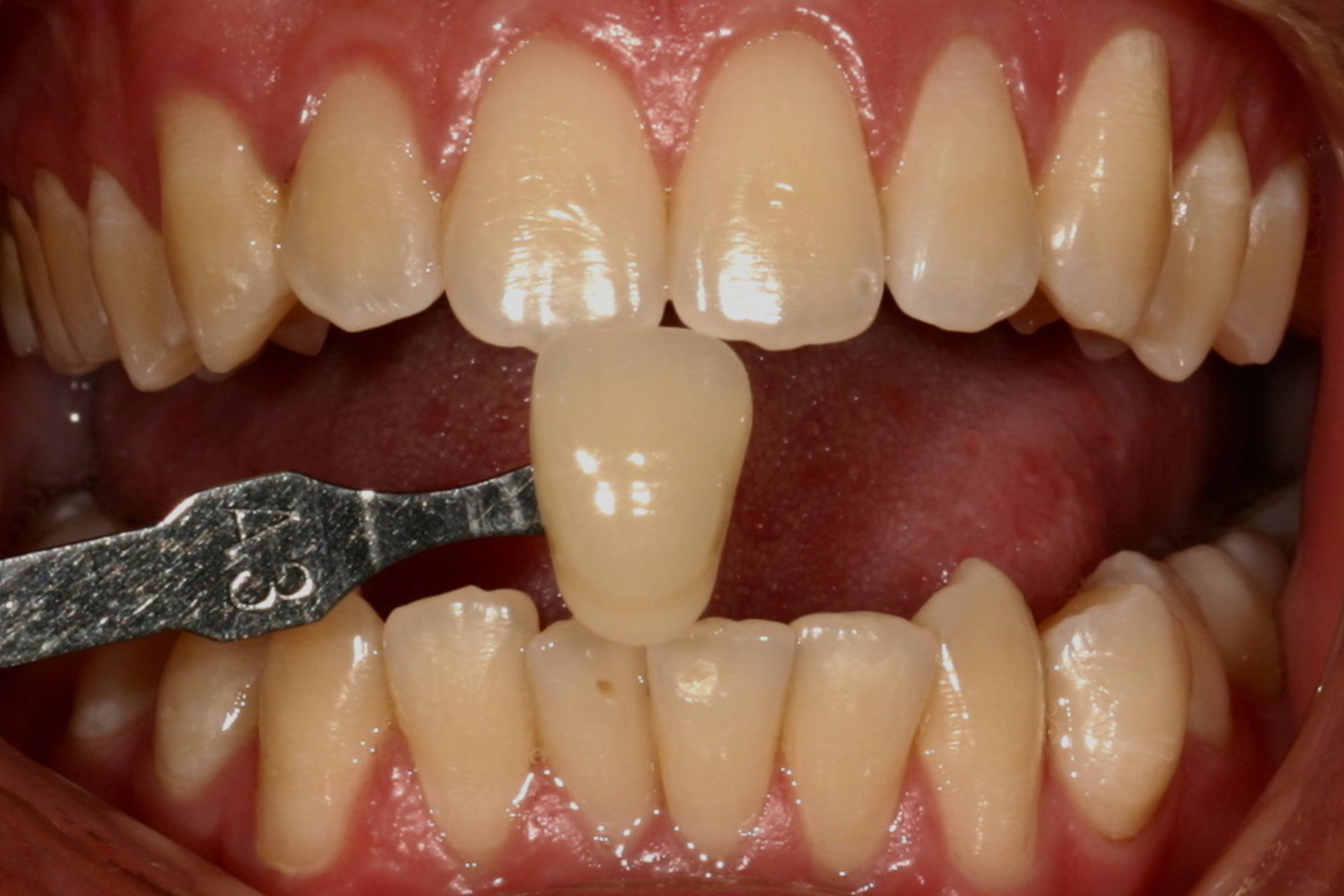 A young girl wearing glasses is smiling for the camera