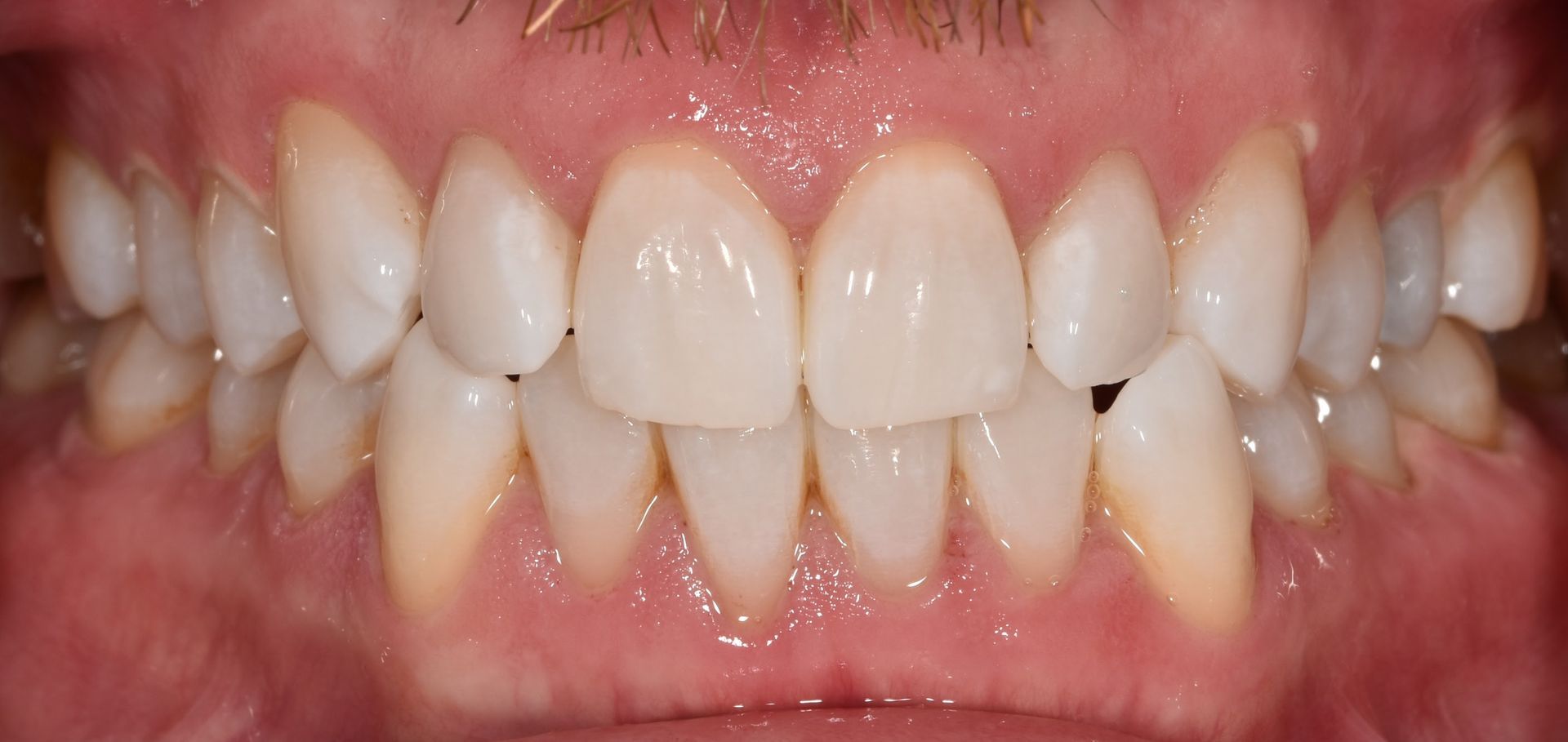 A close up of a man 's face with a smile on his face.