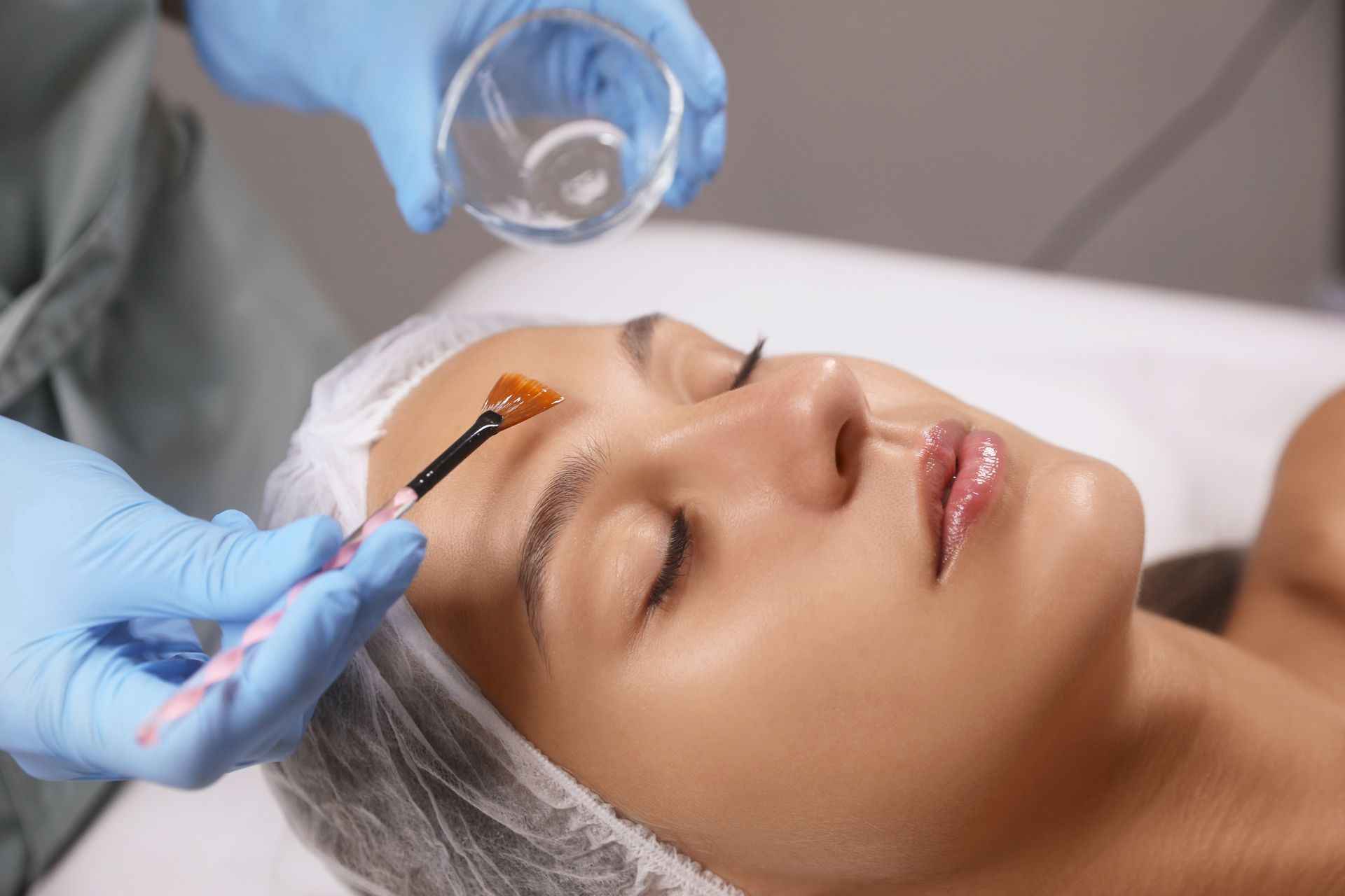 A woman receives a facial peel. A gloved hand applies solution to her forehead with a brush.