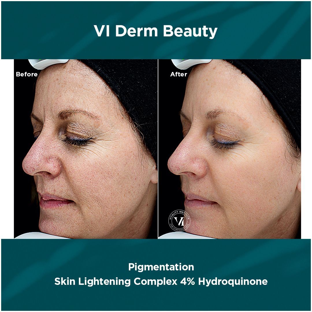 A before and after photo of a woman 's face.