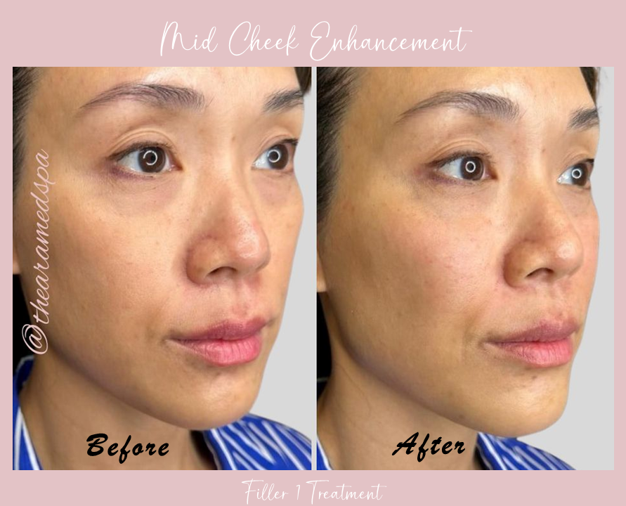 A before and after photo of a woman 's face.