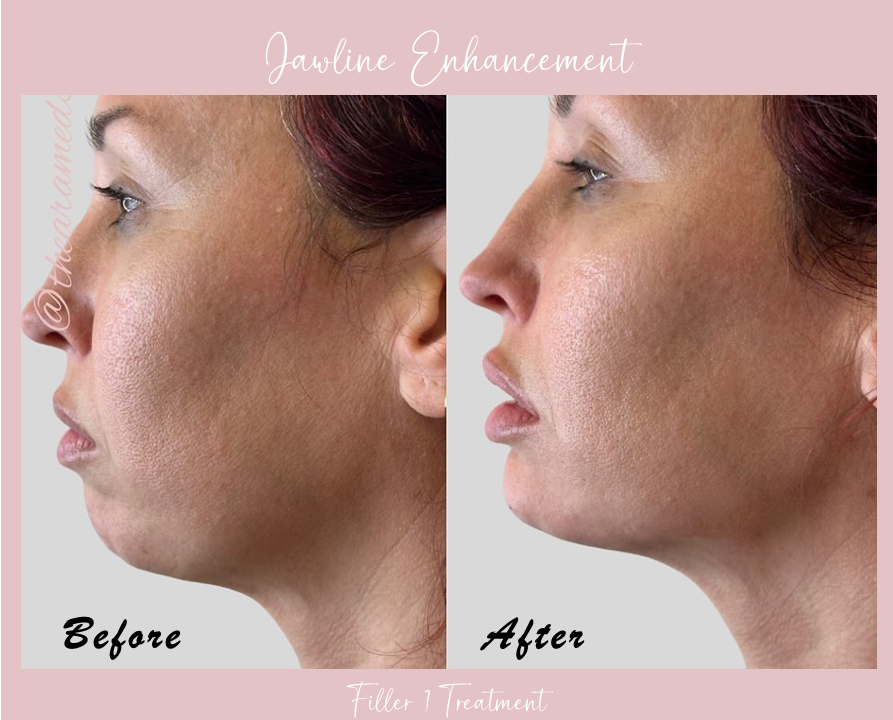 A before and after photo of a woman 's face.