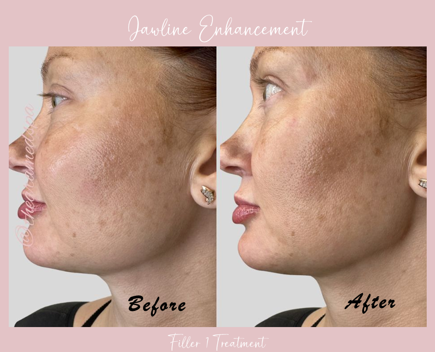 A before and after photo of a woman 's face.