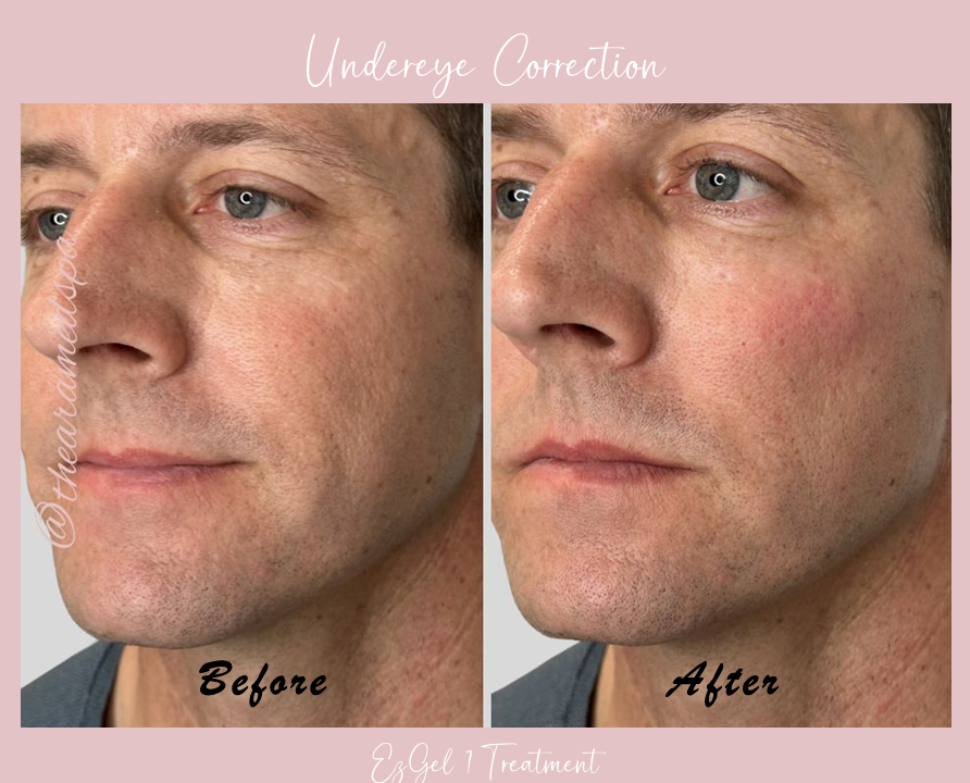 A before and after photo of a man 's face.