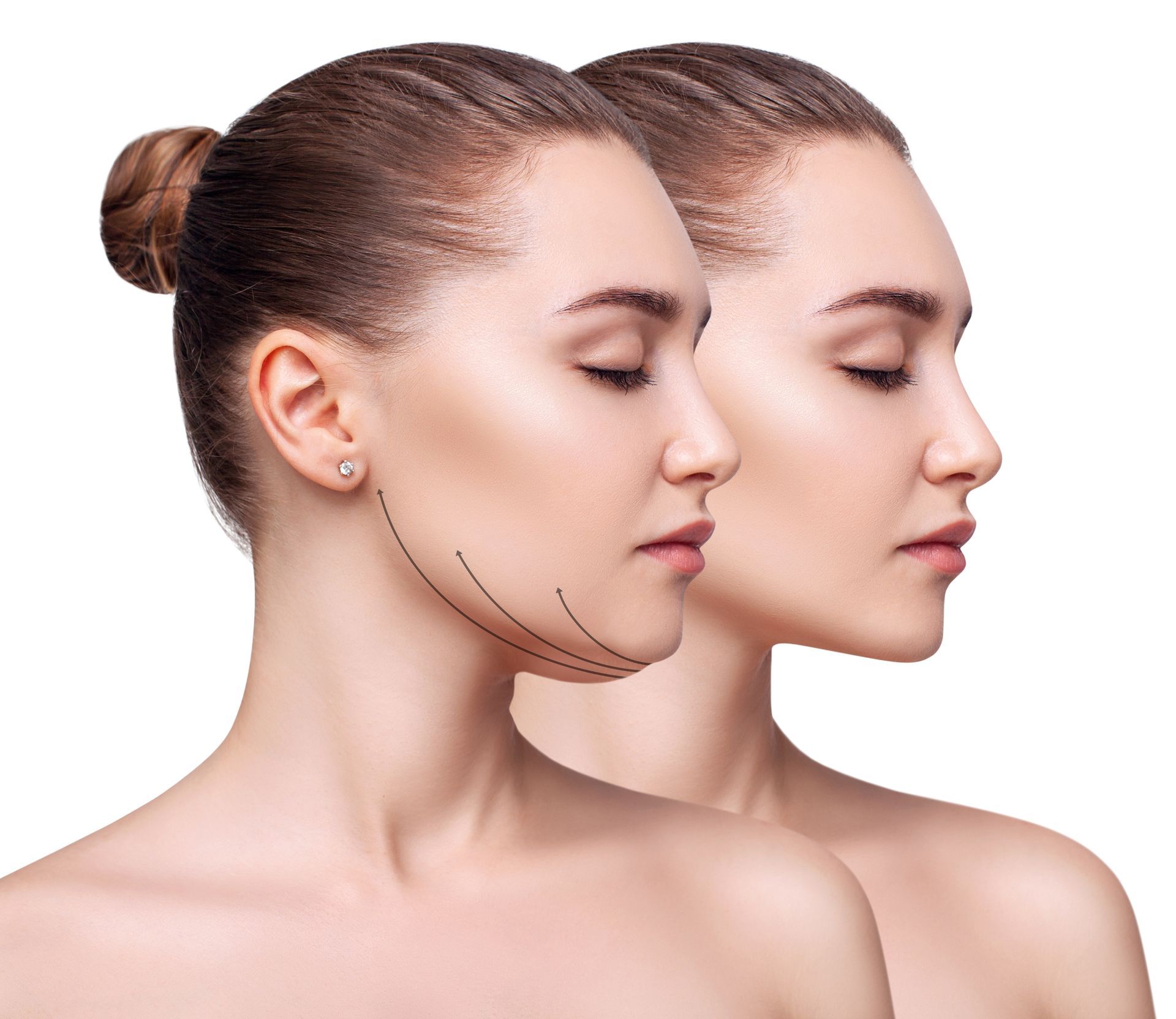 A before and after photo of a woman 's face with a double chin.