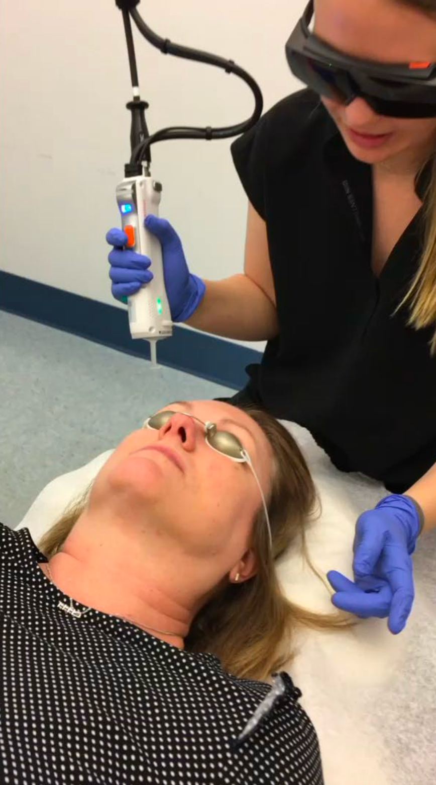A person receives laser facial treatment while wearing protective eye shields, with a clinician holding the device.