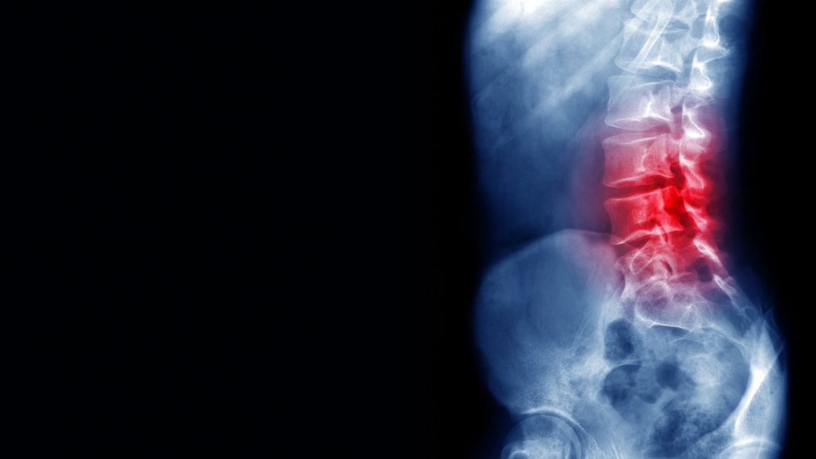 terapia e trattamento su colonna vertebrale