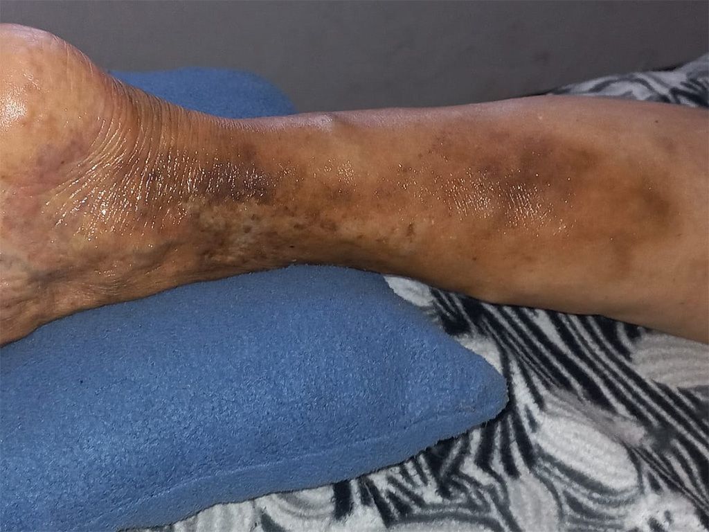 rehabilitación y quiropraxia