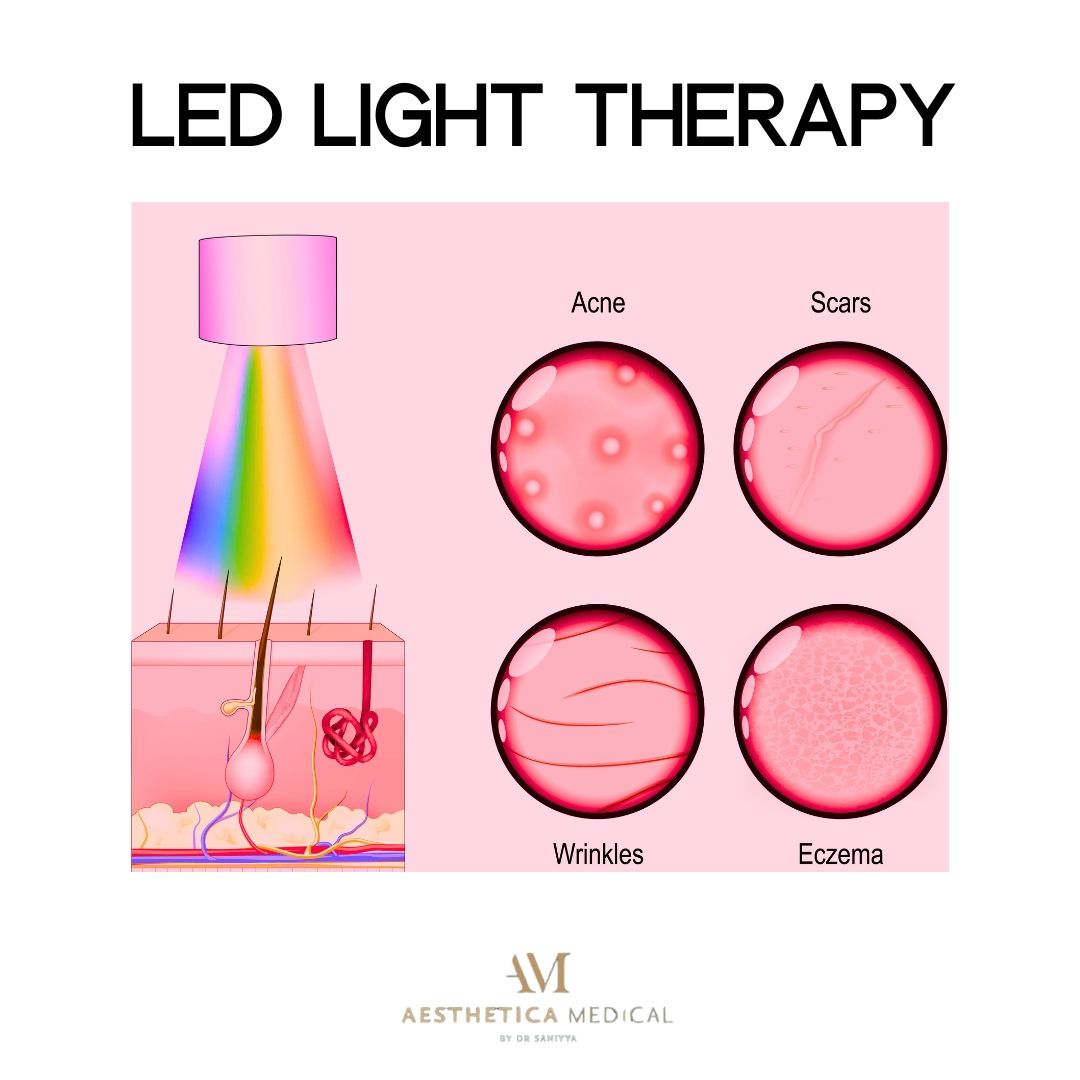 Led light therapy