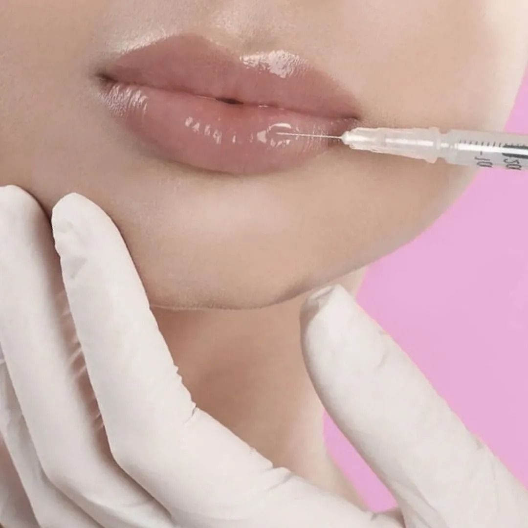 Lip fillers treatment Leeds