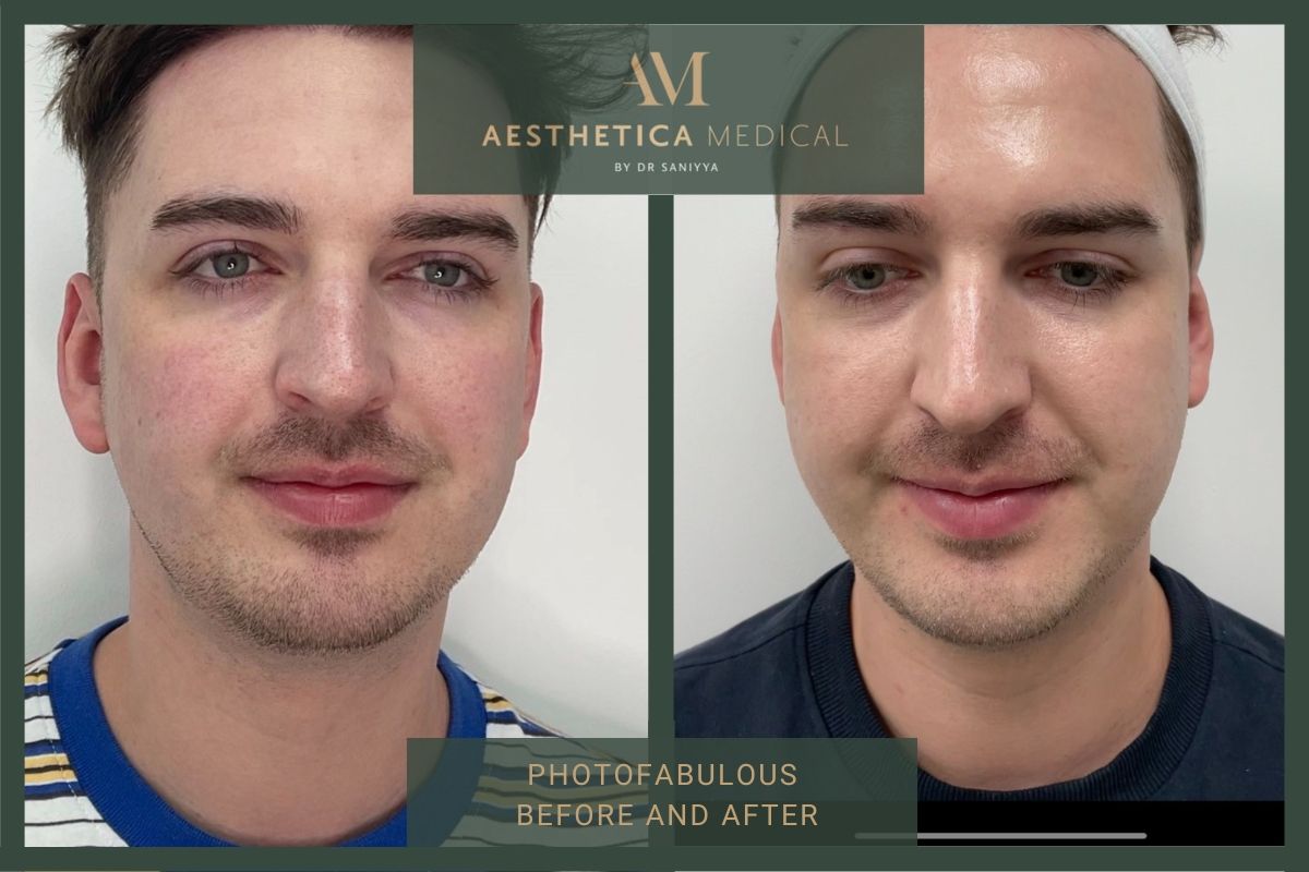 Photofabulous Before And After