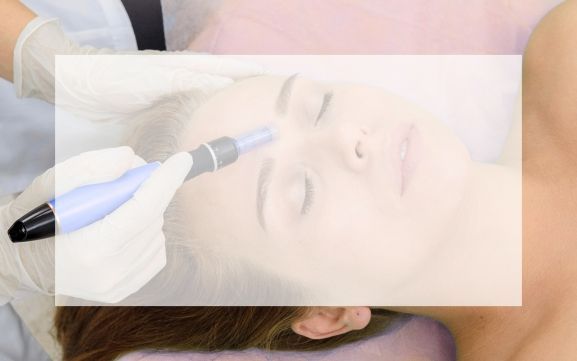 MICRONEEDLINMG PATIENT