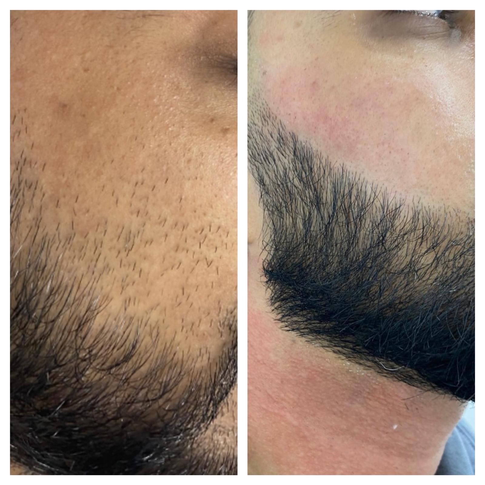 A before and after photo of a man 's beard.