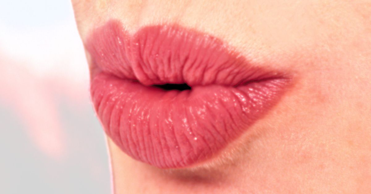 Smokers Lines Treatment