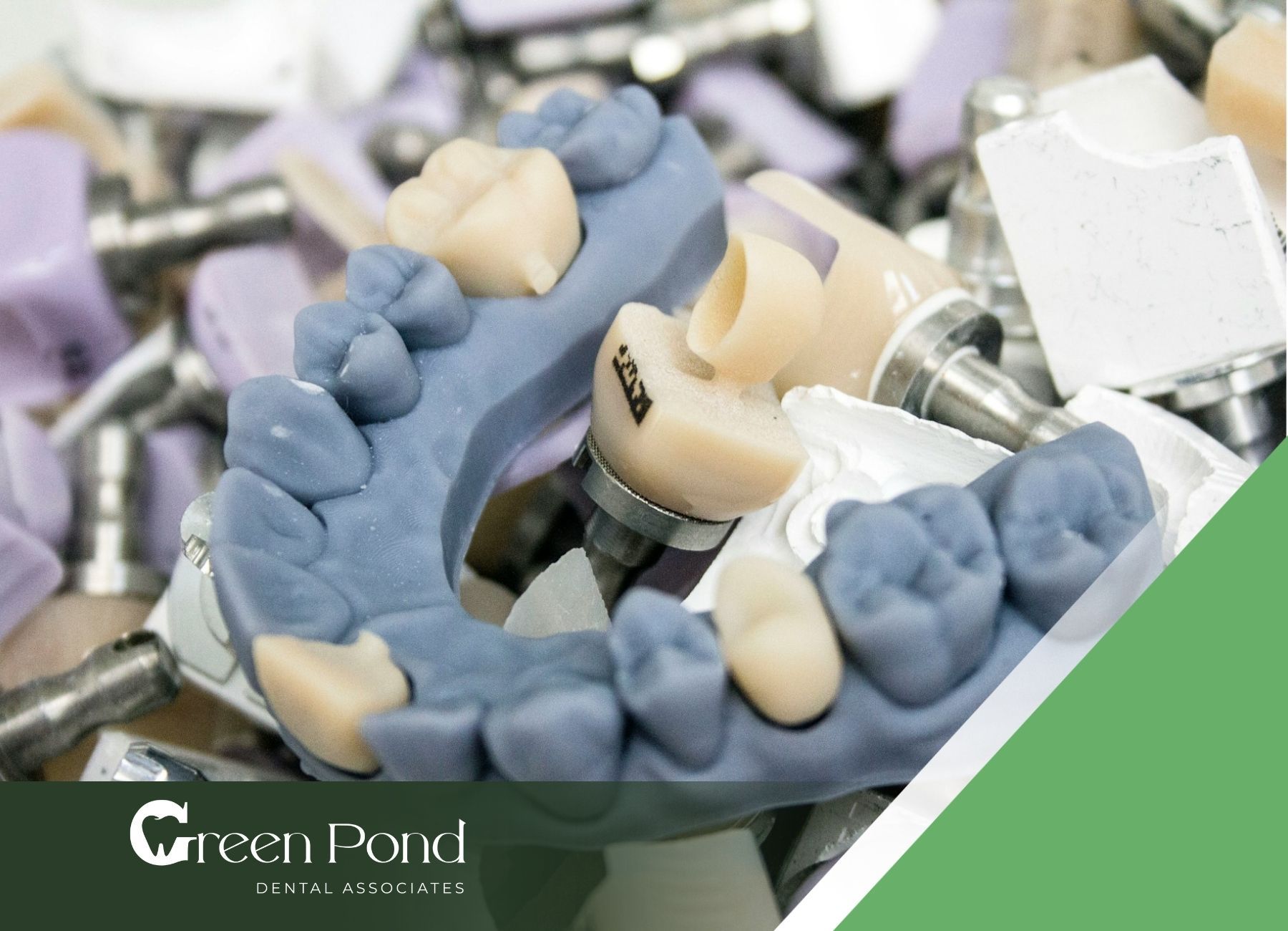 The Average Cost of Dental Crowns | Green Pond Dental