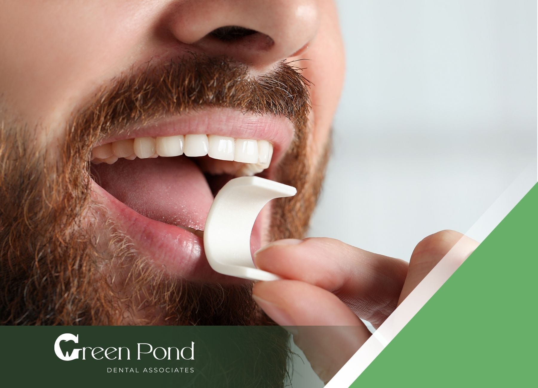 is-chewing-gum-bad-for-your-teeth-green-pond-dental