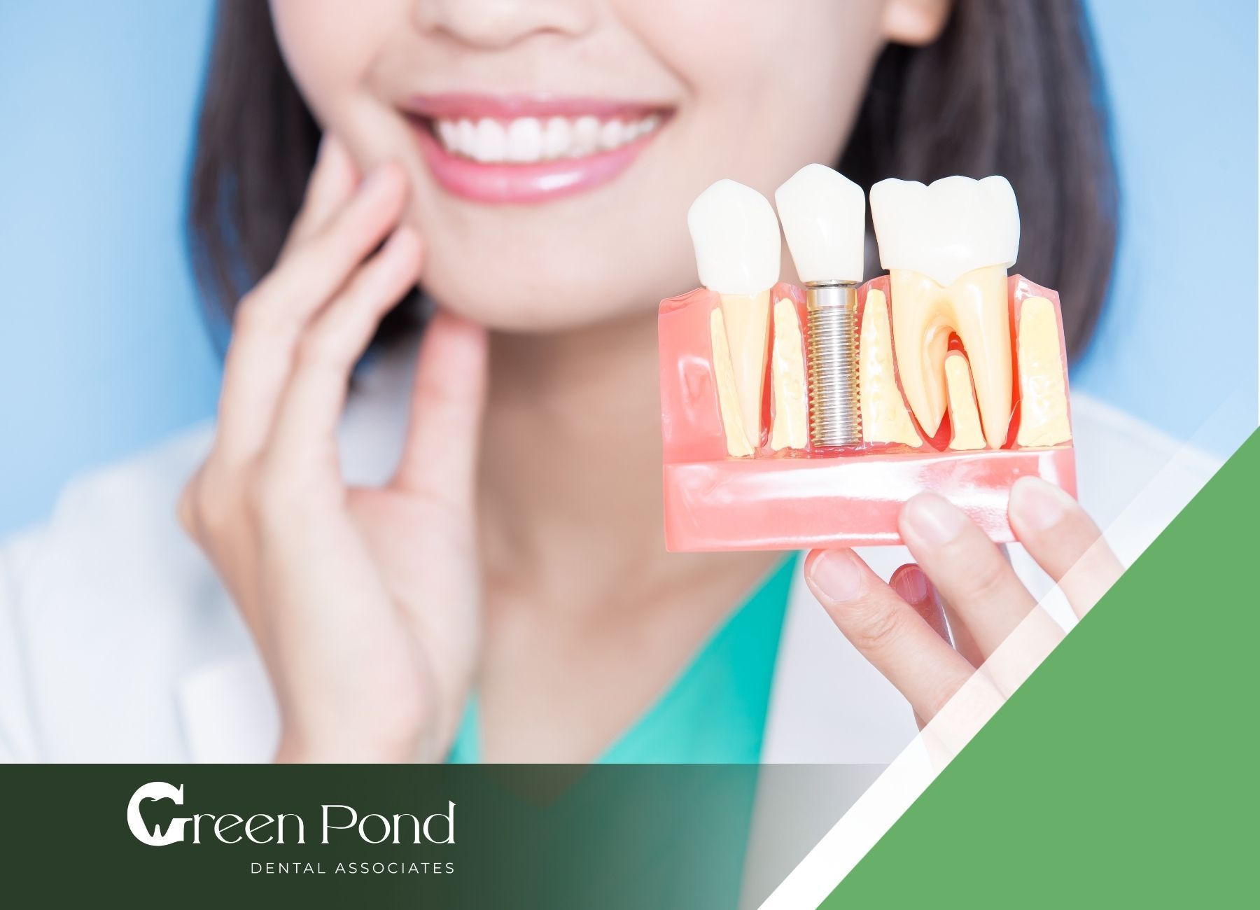 A woman is holding a model of a dental implant in her hand.