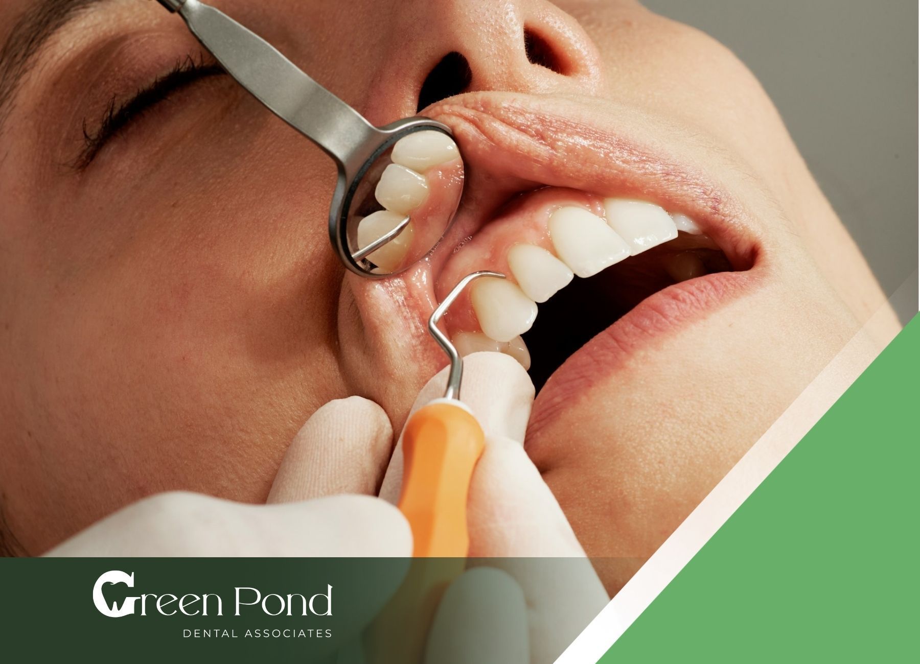 What is a Dental Scaling Procedure? | Green Pond Dental, image size:1800x1300
