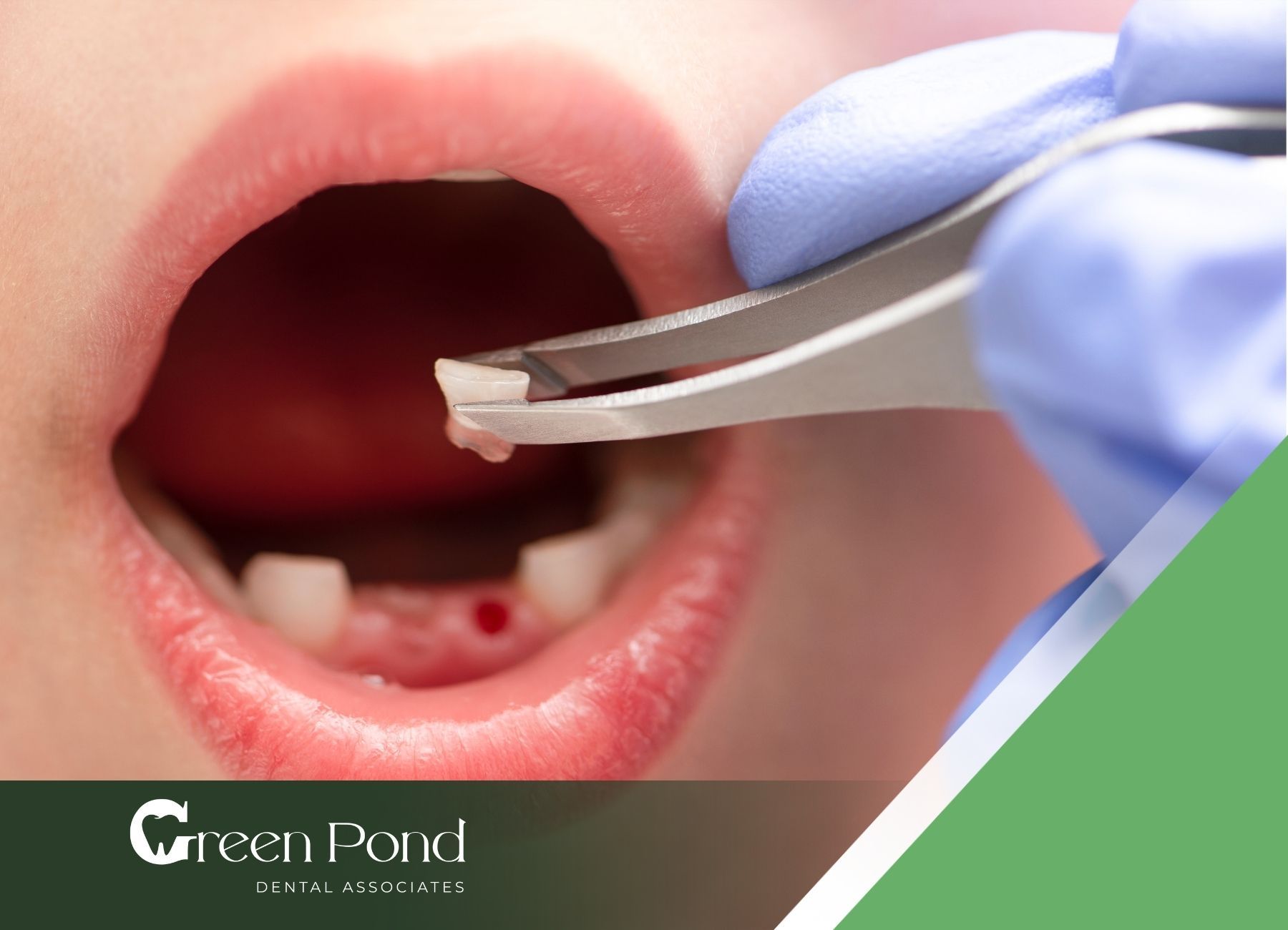 A child 's teeth are being removed by a dentist