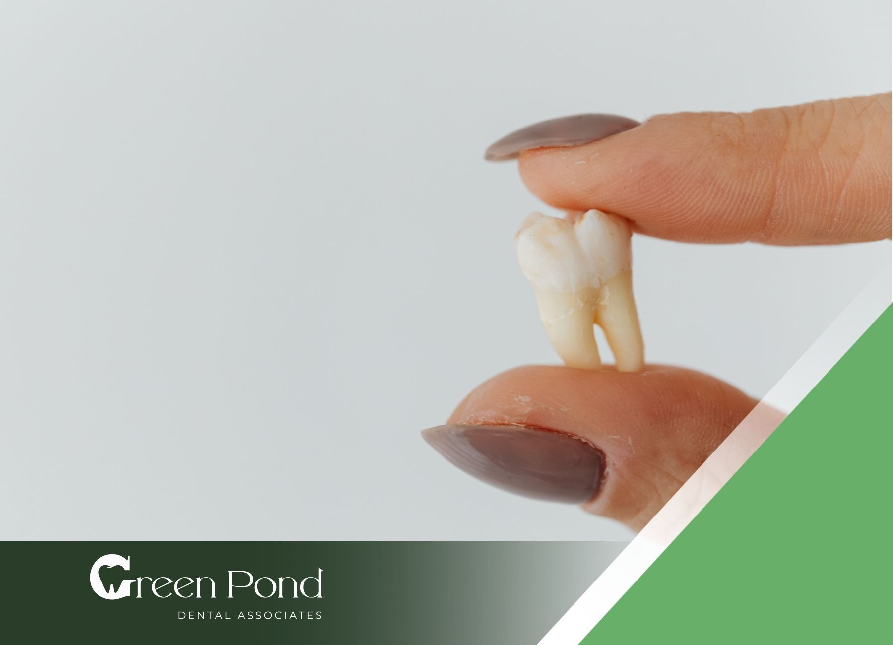 Your Guide to Single Tooth Replacement Options | Green Pond