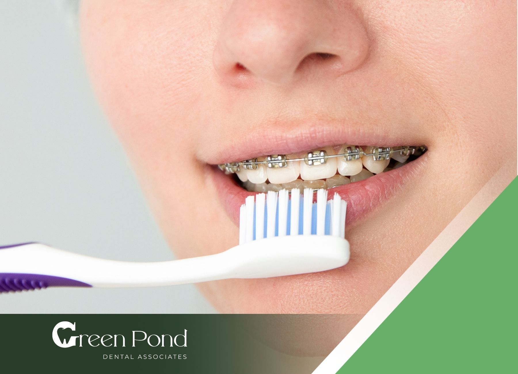 Choosing the Best Toothbrush for Braces Essential Guide