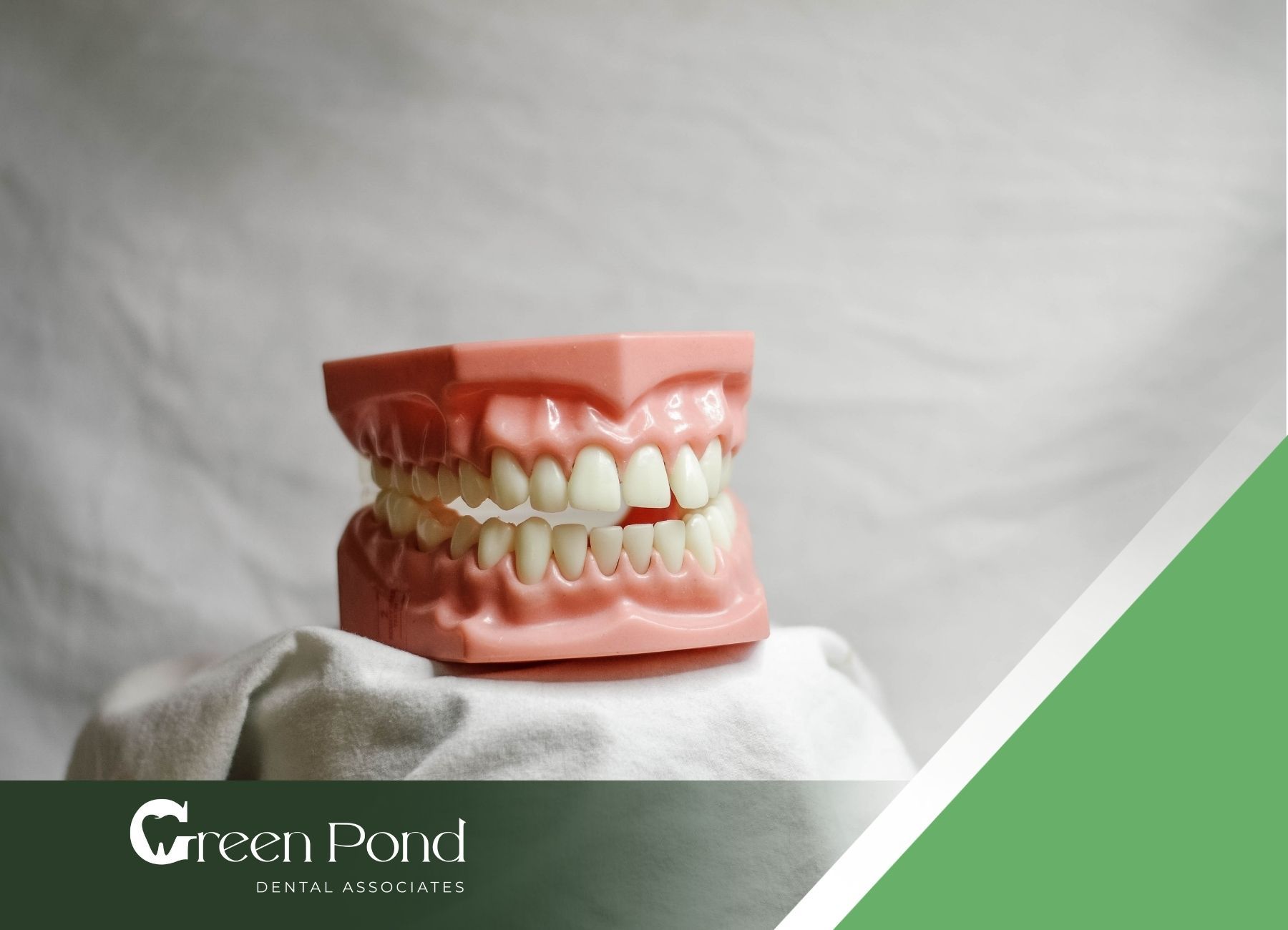 A model of a person 's teeth is sitting on a white cloth.