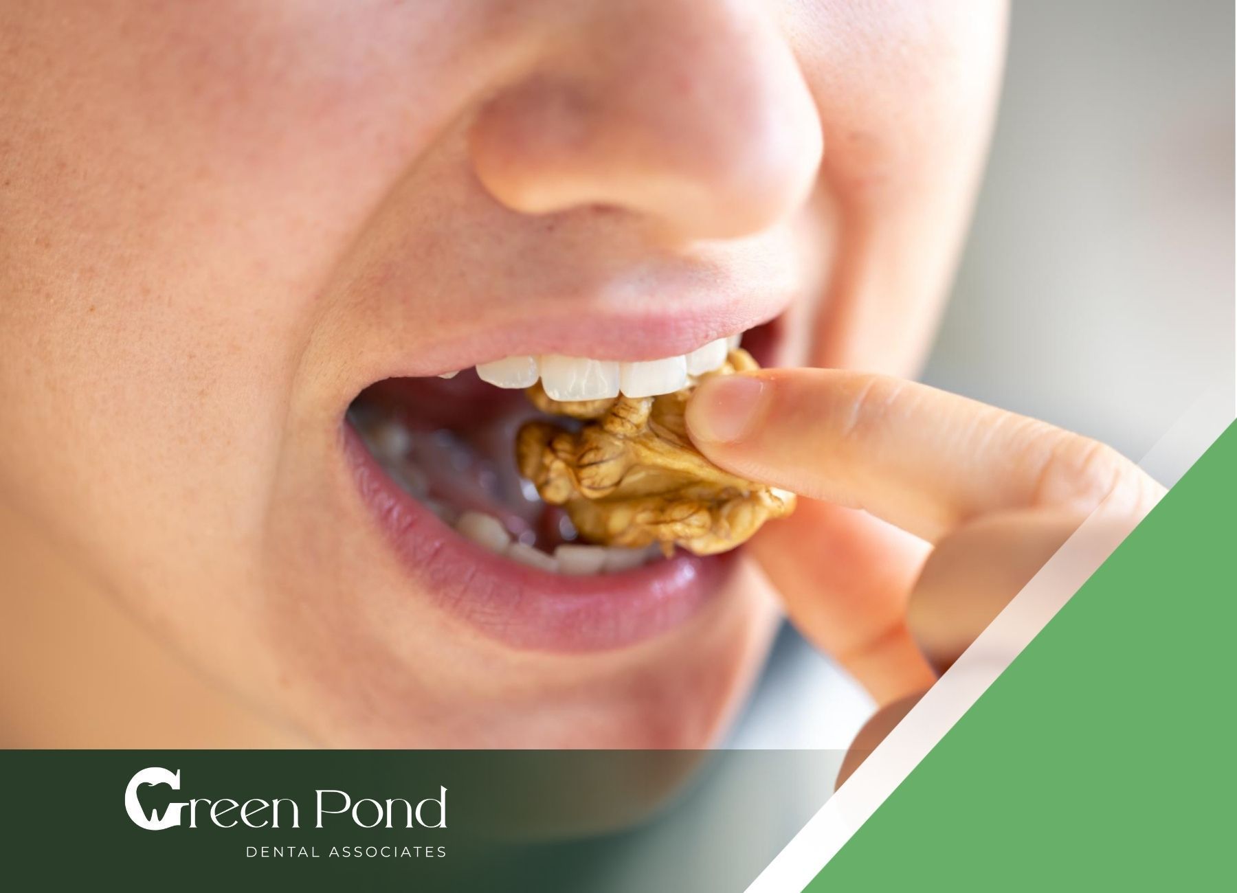 How to Fix Food Traps: Simple Tips for Clean Teeth