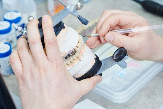 Hands using a brush to detail dental impressions held in a metal support frame.