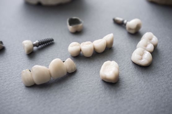 Dental crowns and bridges on a gray surface, various shapes and sizes, all light beige.