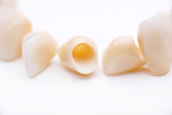 Dental crowns, close-up on white background. Light beige color, hollow insides.