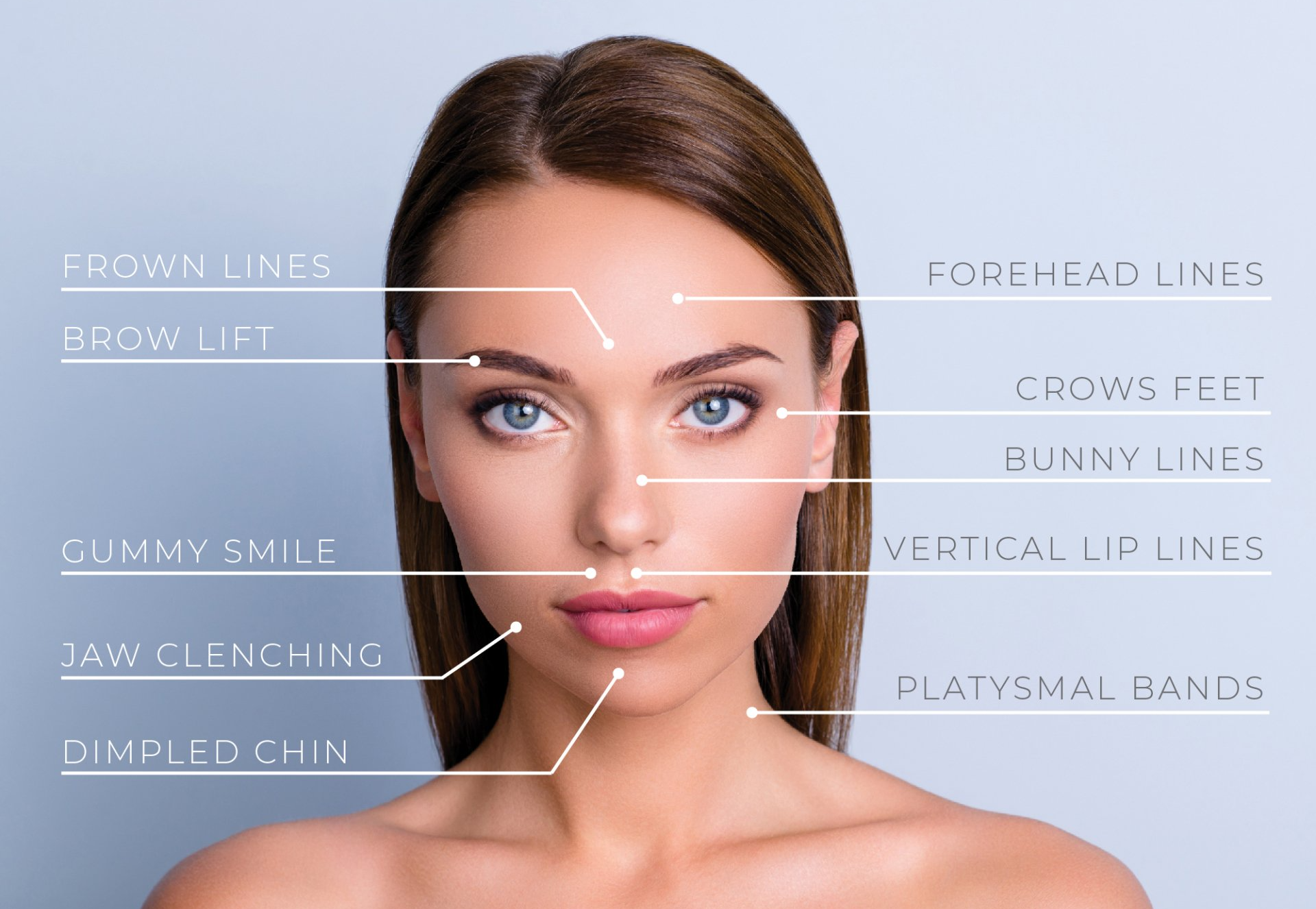 Cosmetic wrinkle relaxers targeted area diagram