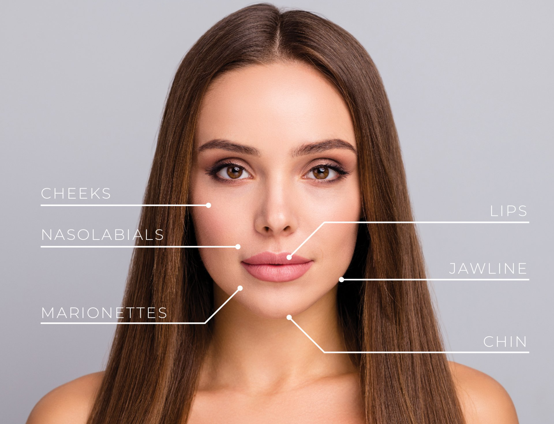 Diagram of dermal filler placement