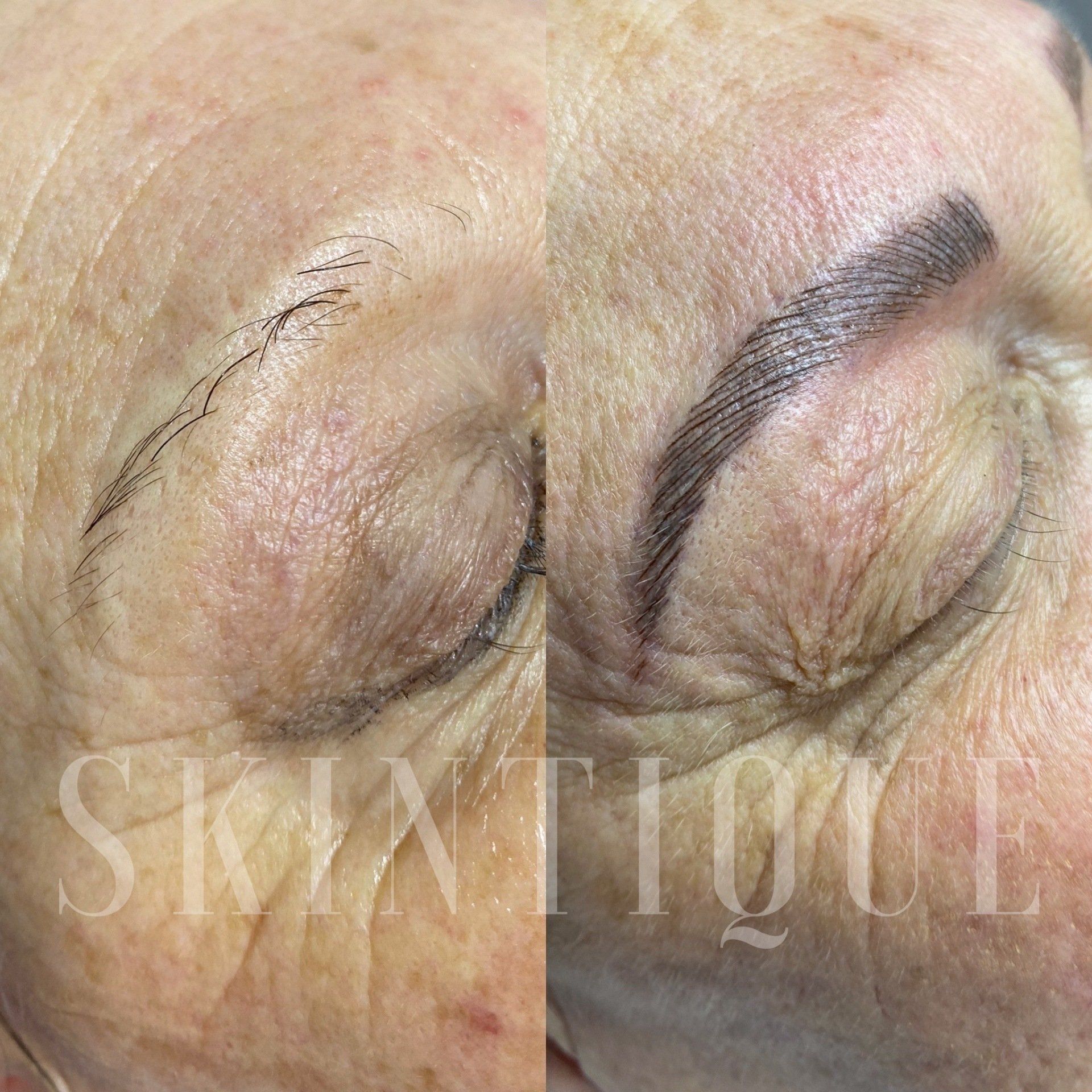 Skintique cosmetic eyebrow tattooing before and after