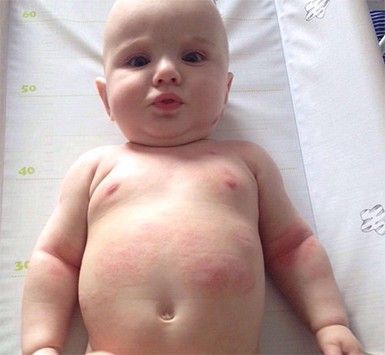 A baby without a shirt is laying on a changing table