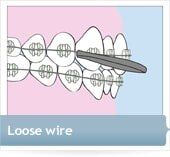 loose-wire