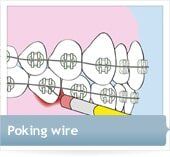poking-wire