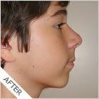 Class2_Profile_After