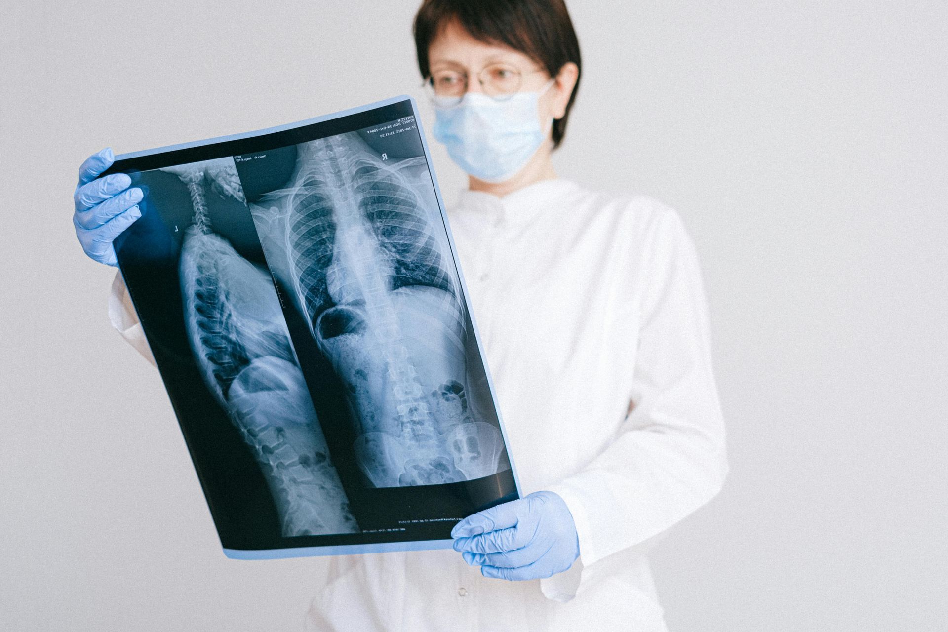 Doctor in mask and gloves examines an X-ray of a person's chest.