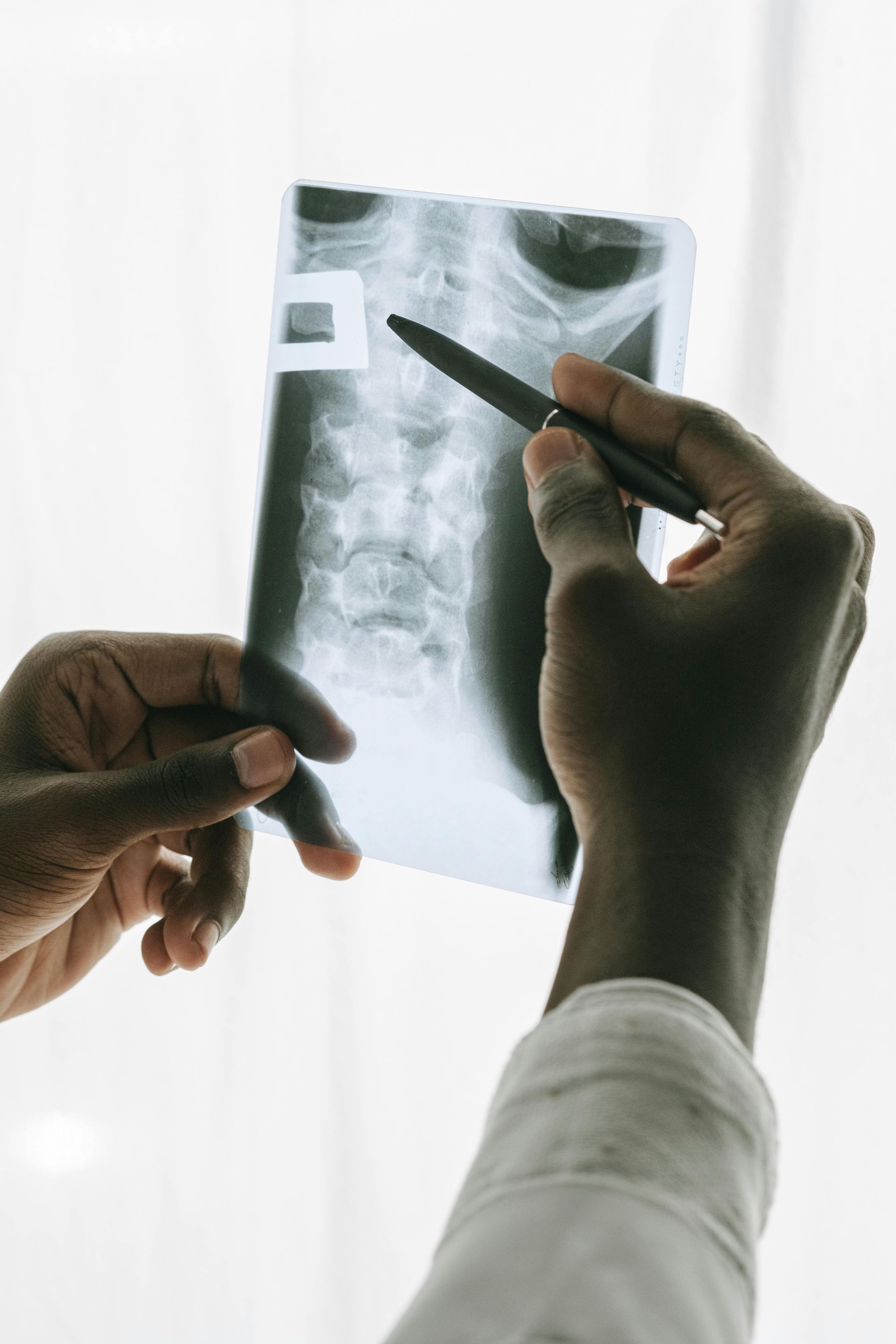 Hands holding up and pointing at an X-ray film, likely by a medical professional.