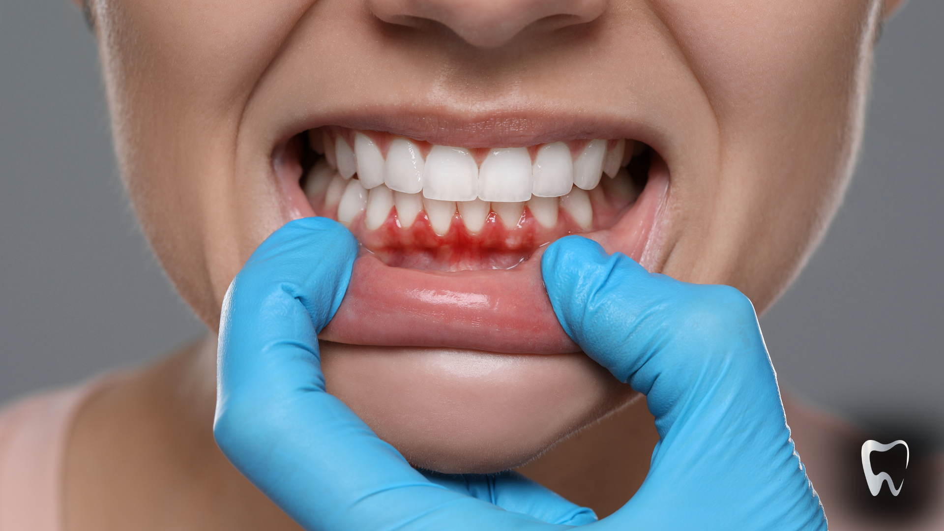 A woman is getting her teeth examined by a dentist.