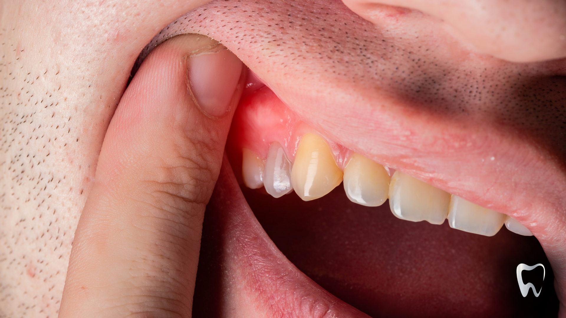 A close up of a person 's mouth with a toothache.