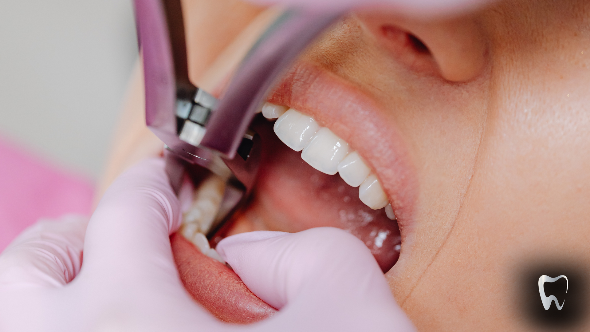 A woman is getting her teeth examined by a dentist.