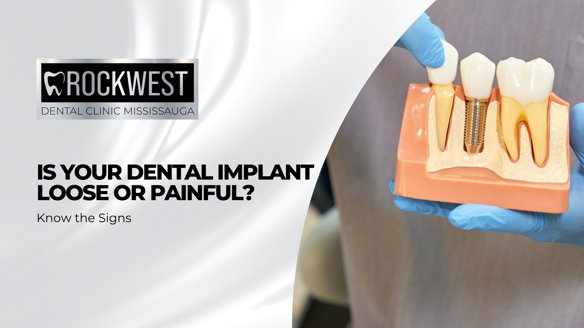 A person is holding a model of a dental implant.