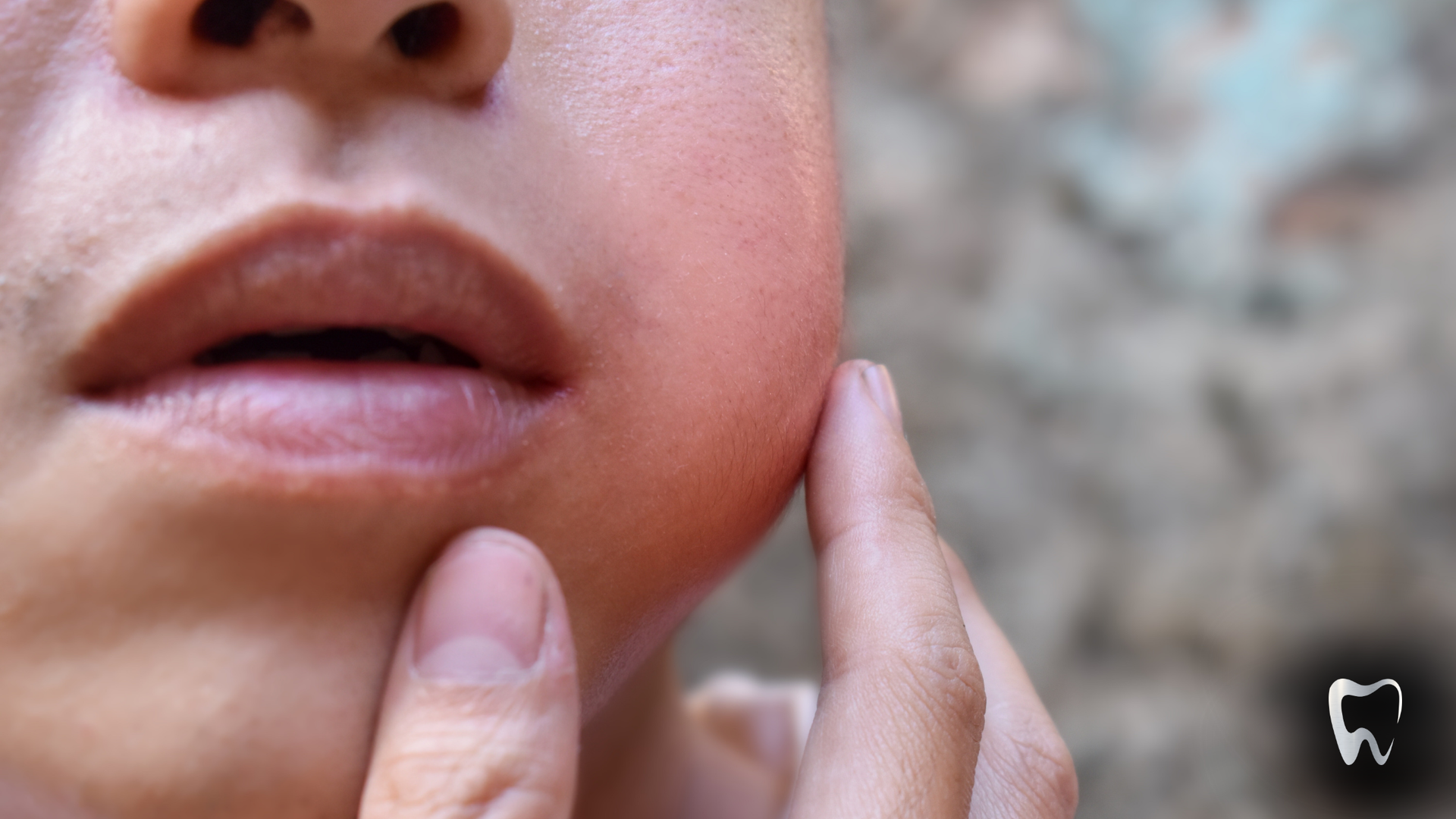 A close up of a person 's face with a tooth visible