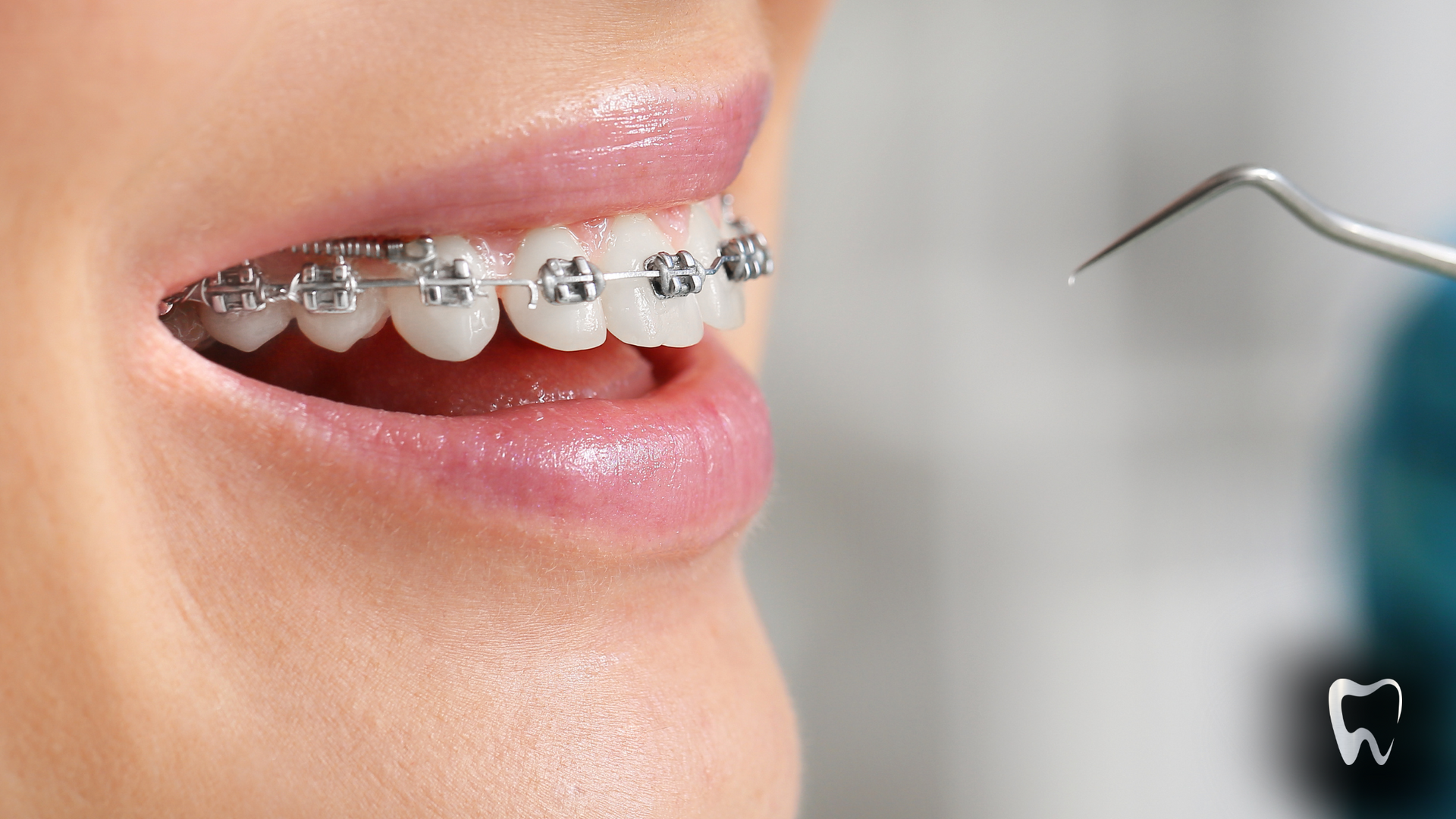 A woman with braces on her teeth is getting her teeth examined by a dentist.