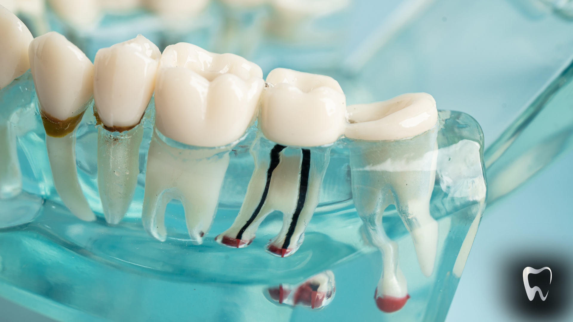 A close up of a model of a tooth with roots in it.