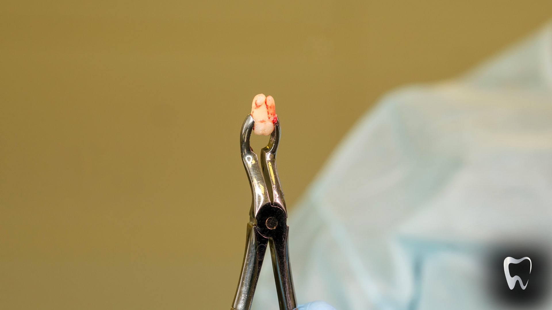 A close up of a pair of pliers holding a tooth