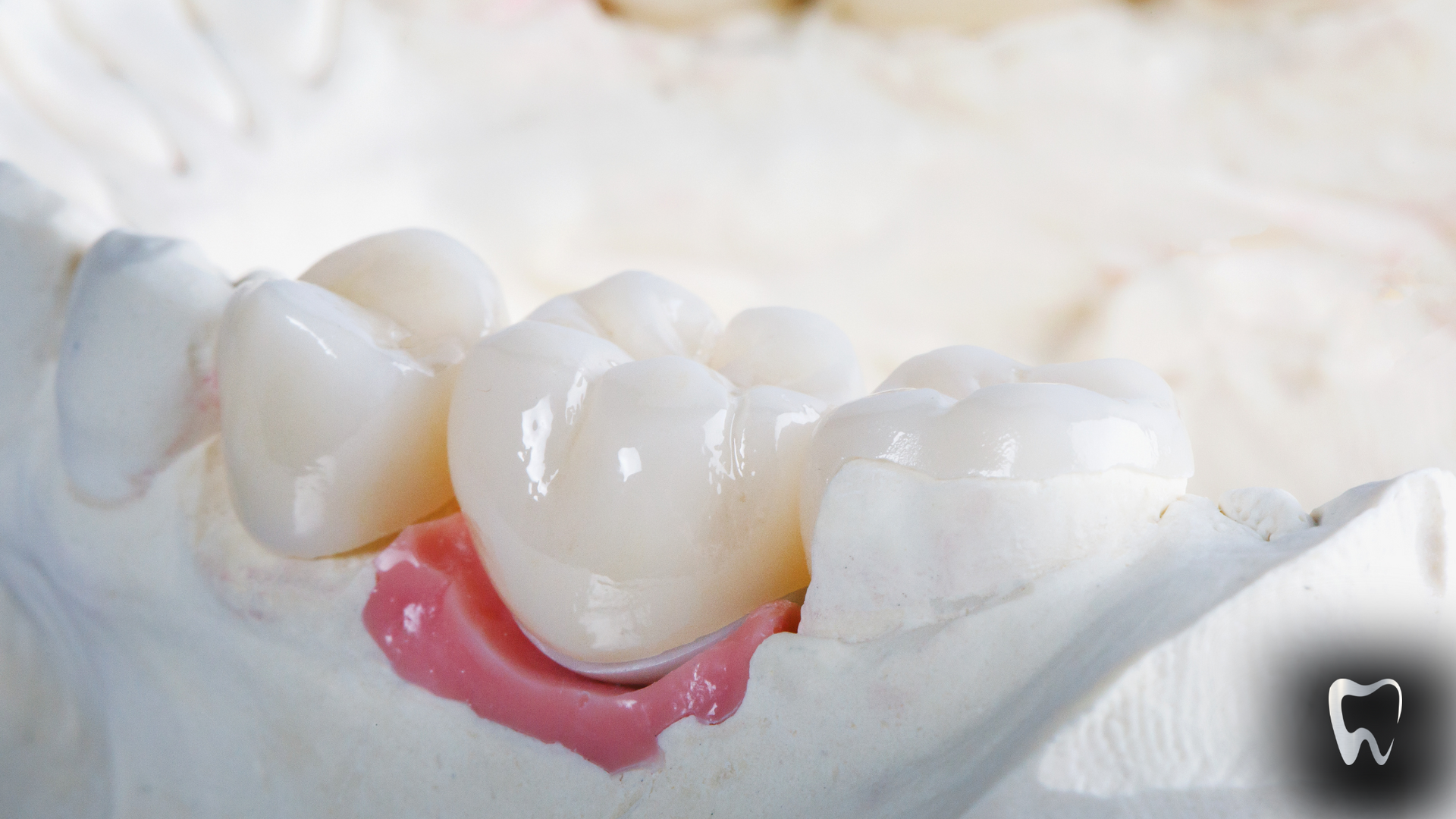 A close up of a model of a person 's teeth on a table.